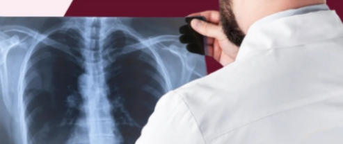 X-ray scan